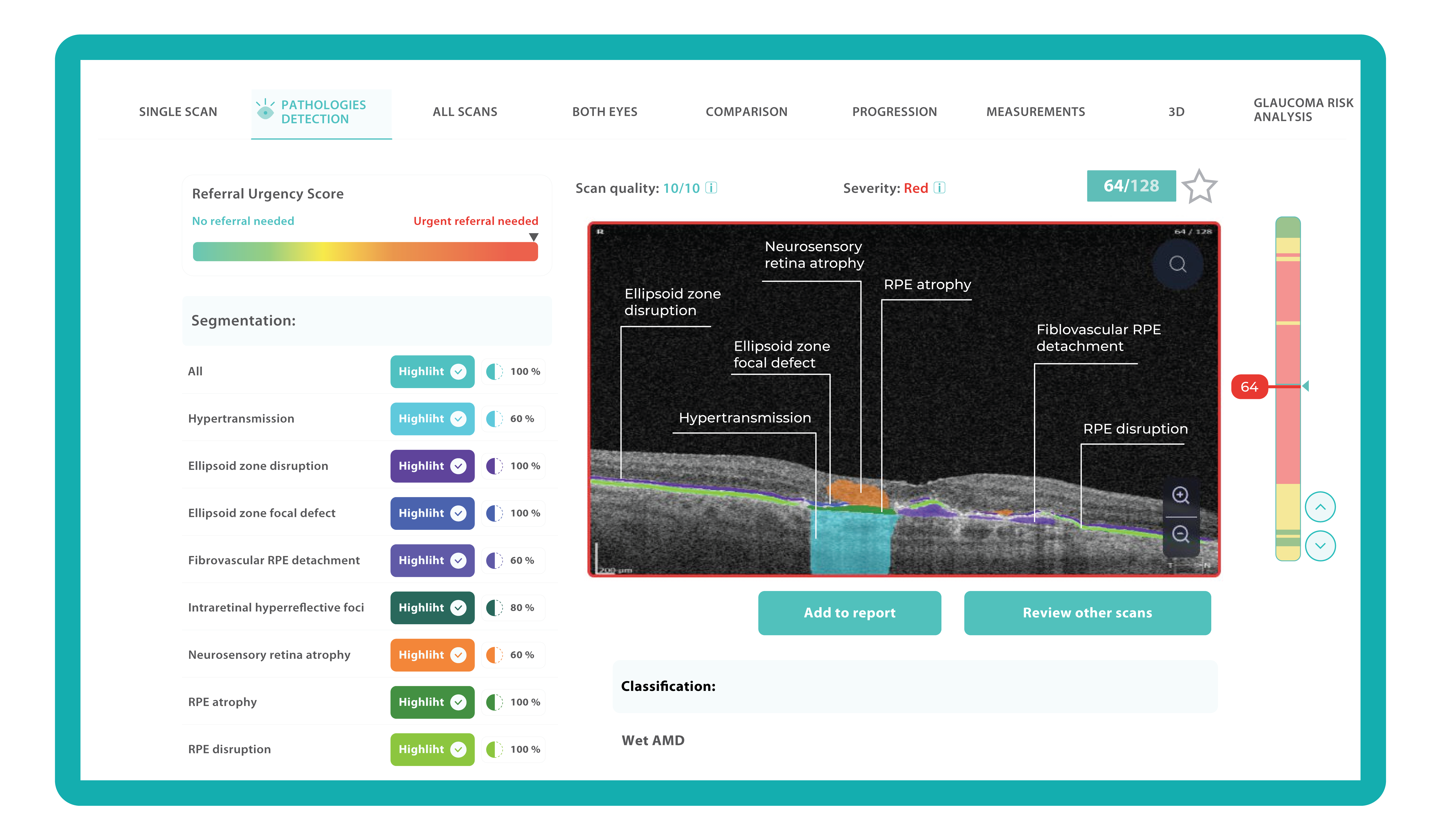 Optometry trends