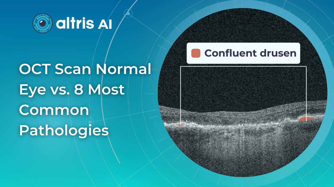 normal abnormal oct scan