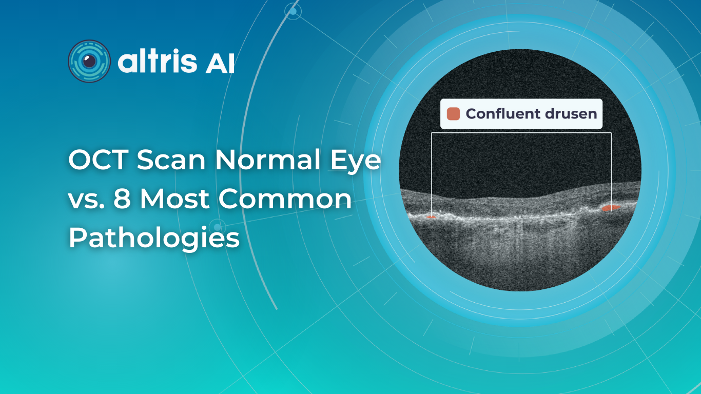 normal abnormal oct scan