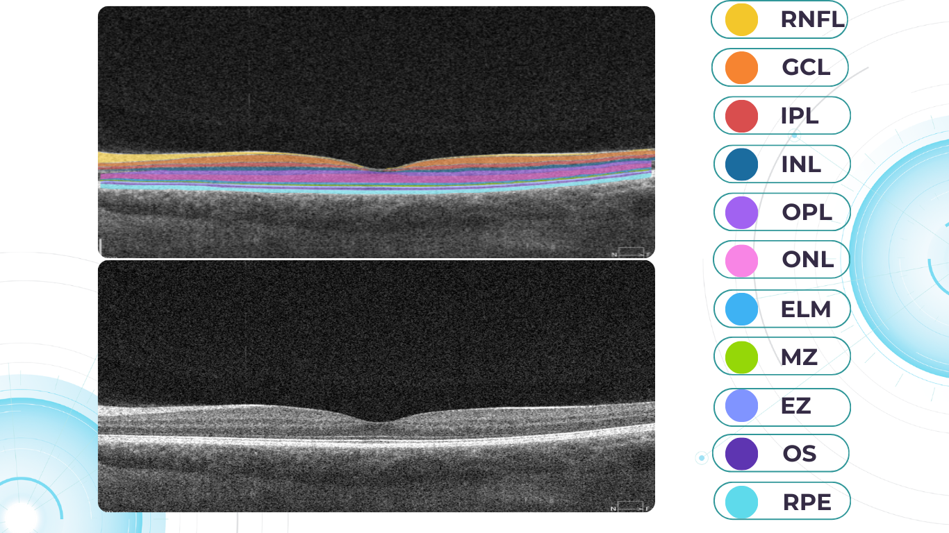 normal macula oct