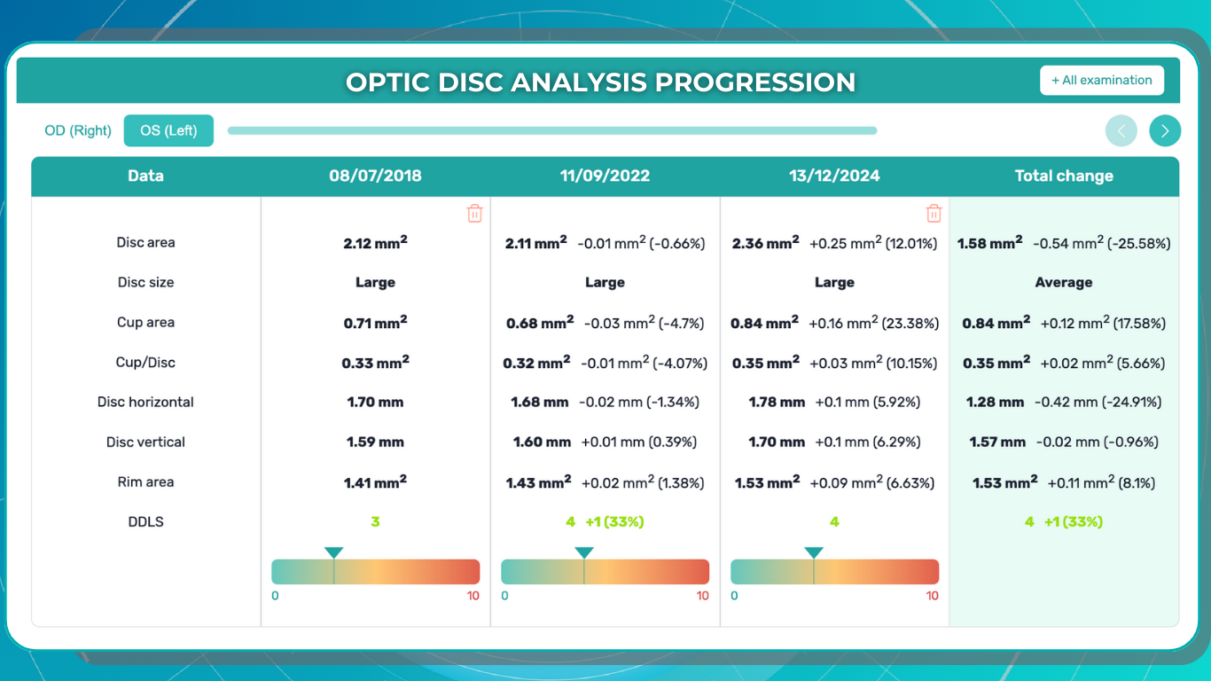 Optic Disc analysis